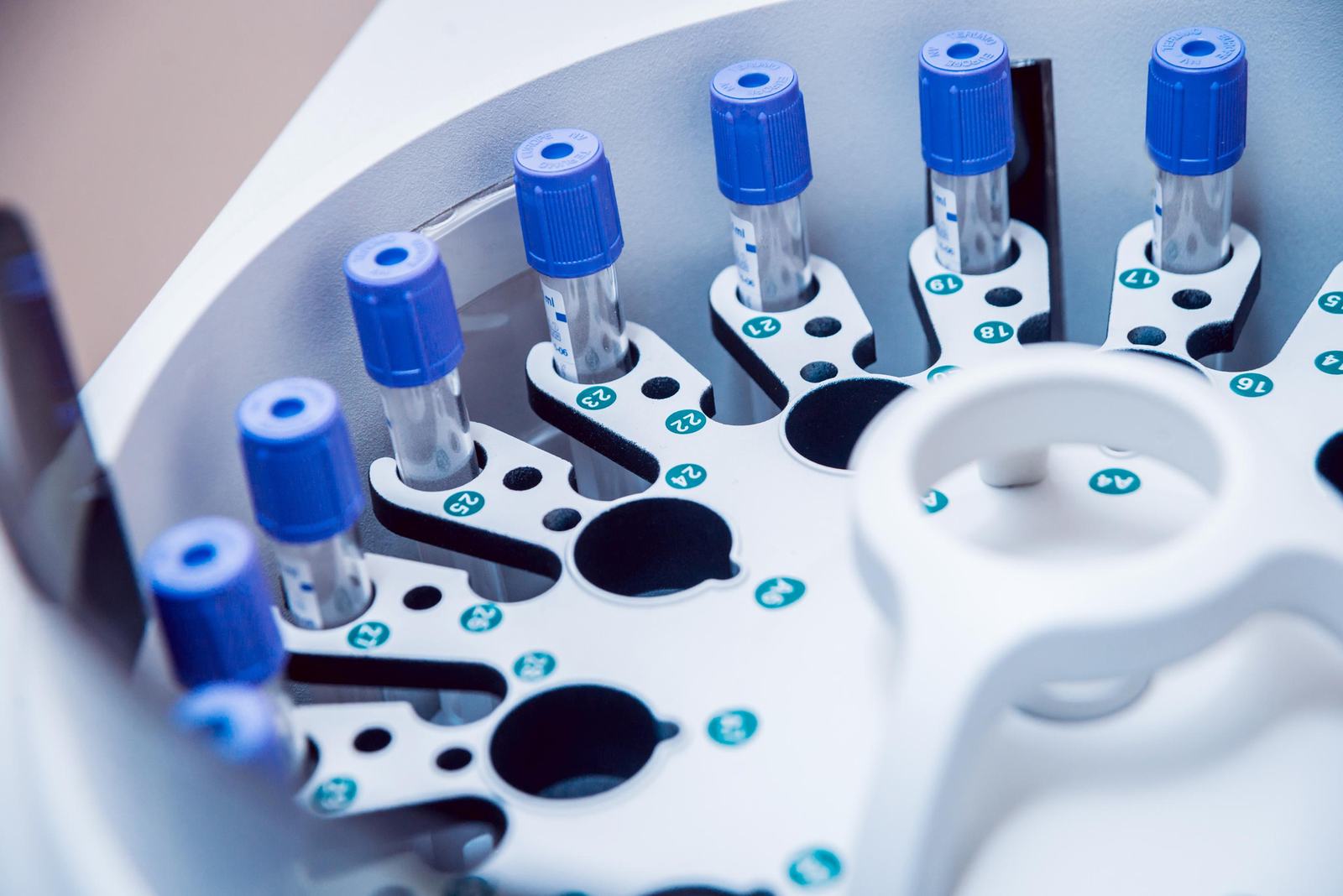 Laboratory test tubes in a rack